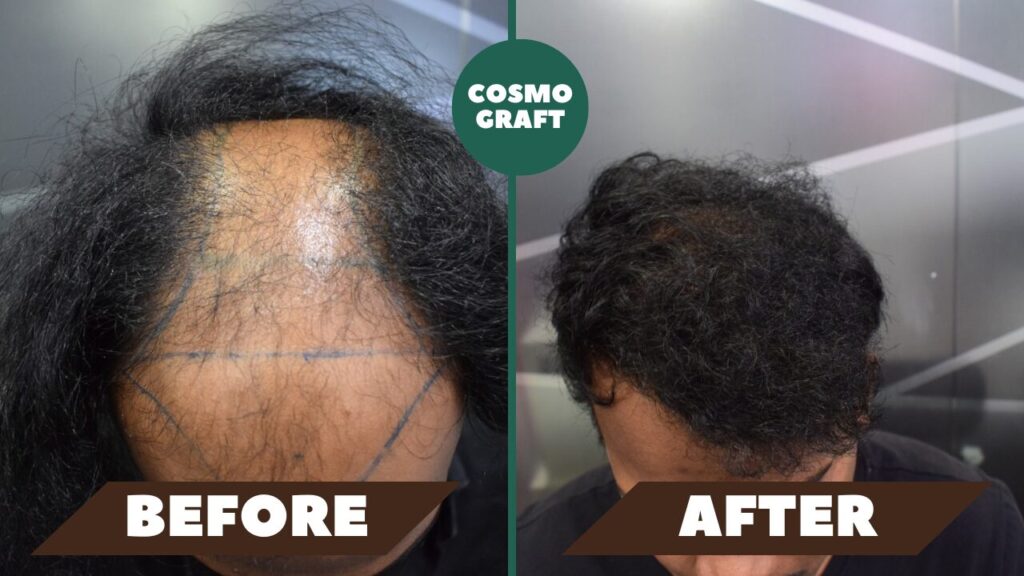 Our patient result